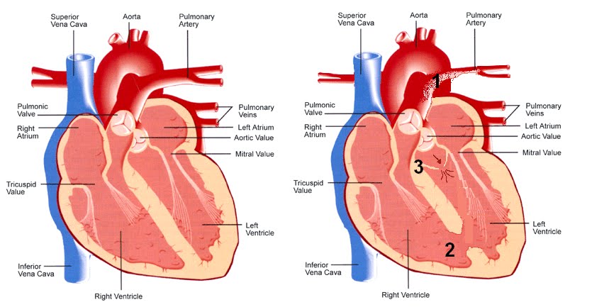 human+heart+diagram The+human+heart+for+kids The+human+body+ ...