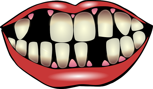 Clipart gap in teeth