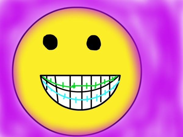 Gallery For > Smiley Face With Braces Text