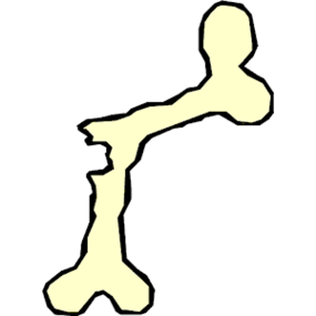 Broken Arm Clipart Clipart - Free to use Clip Art Resource