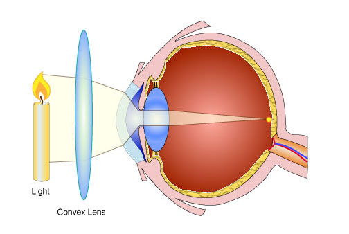 Use of lenses for correcting vision - Pass My Exams: Easy exam ...