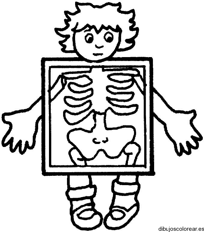 Xray Black And White Clipart ClipArt Best ClipArt Best