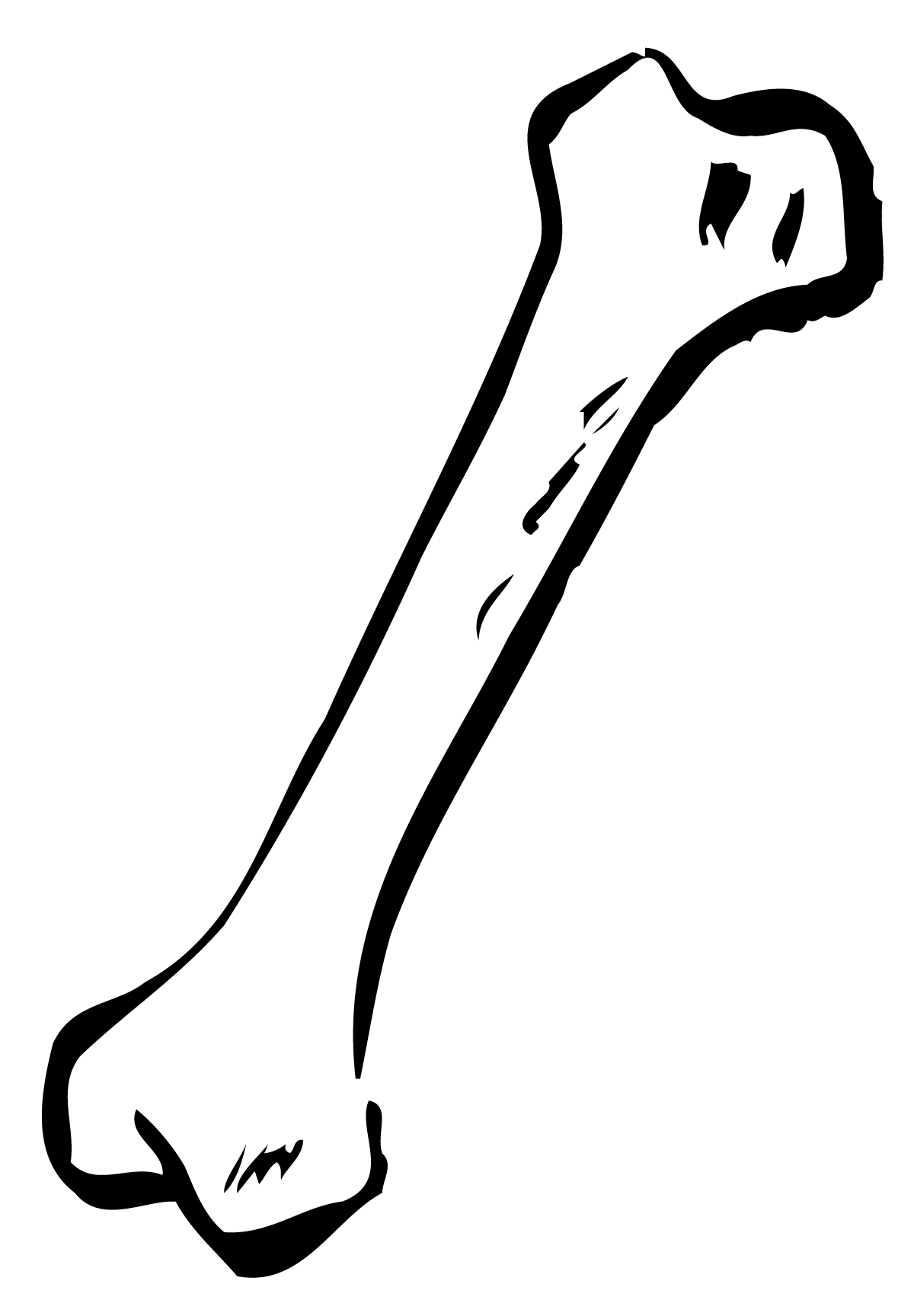 About Broken Bones Clipart