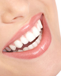 Findlay Smile Makeovers | Cosmetic Dentists McComb | Findlay Teeth ...