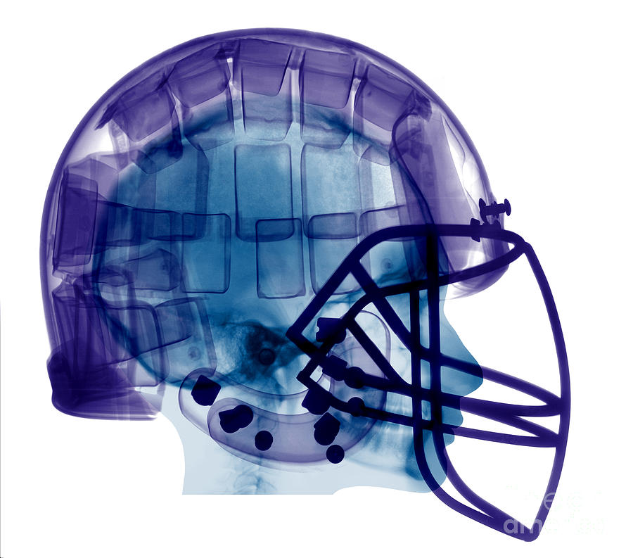 Football Helmet, X-ray Photograph by Ted Kinsman - Football Helmet ...