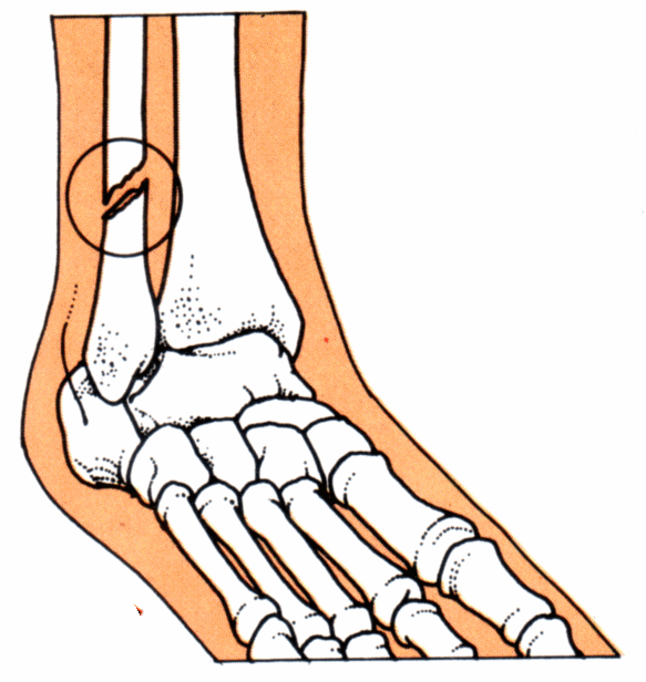 human leg clipart - photo #31