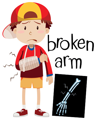 Broken Arm Clip Art, Vector Images & Illustrations