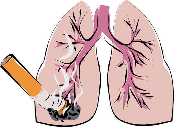 Lung Cancer: Caused by Smoking