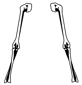 Arm Bones Diagram - ClipArt Best