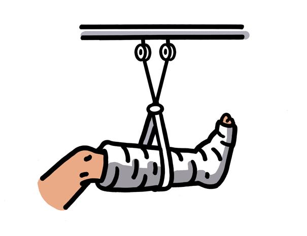 35+ Broken Leg Cartoon Clipart