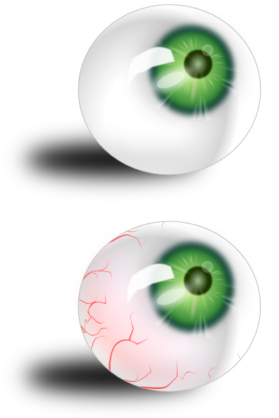 Eyeballs Green And Bloodshot clip art - vector clip art online ...