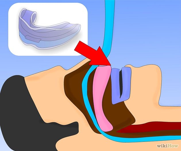How to Stop Snoring 8 Steps (with Pictures) wikiHow ClipArt Best
