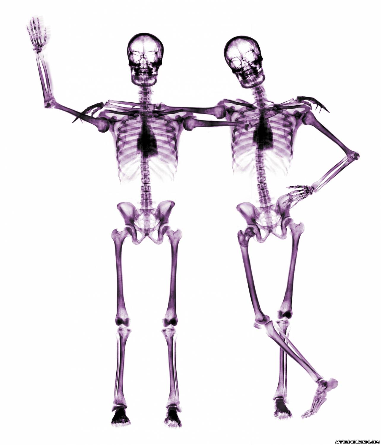 Picture of Two Human Body Skeletons, One is waving his hand saying BYE .