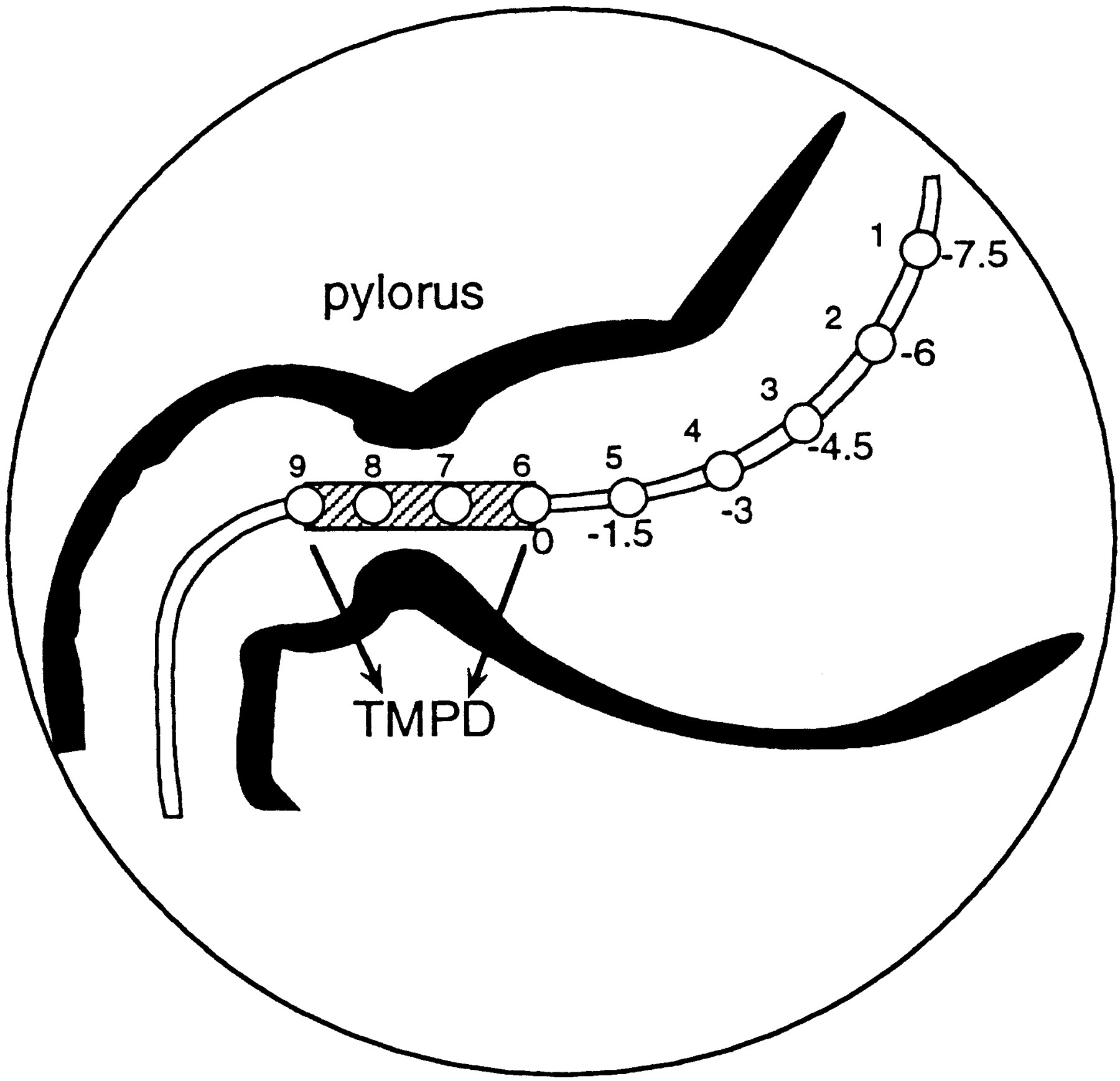 Effects of nitroglycerin on liquid gastric emptying and ...