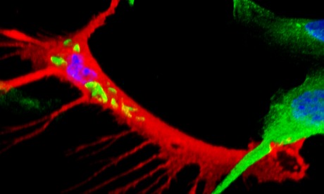 Leprosy spreads by reprogramming nerve cells into migratory stem ...