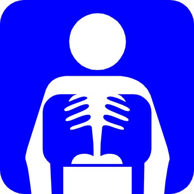 X Ray Clip Art - ClipArt Best