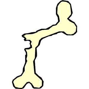 Broken Bone Clipart - Tumundografico