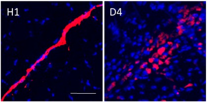 FLB-Movement-by-Macrophages- ...