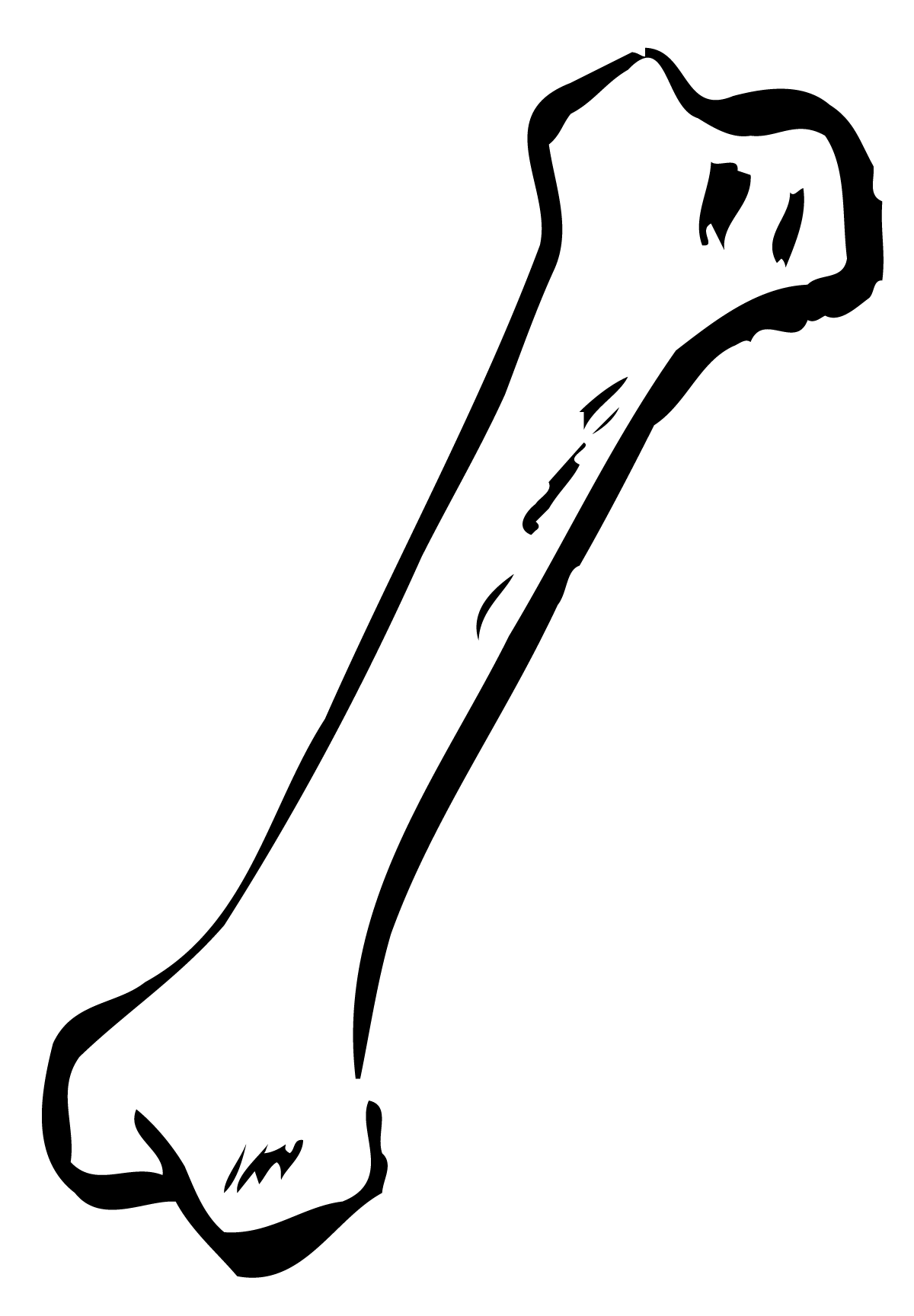 Human Broken Bones Clipart