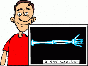 X Ray Clip Art - Tumundografico