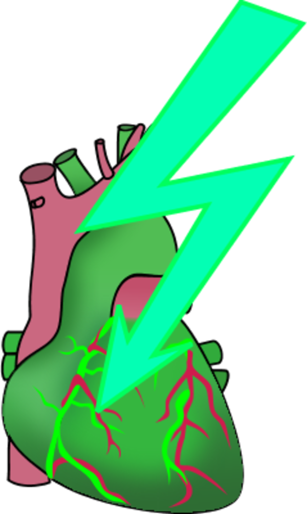 human hear with an electricity bolt signaling a heart attack ...