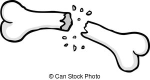 Broken bones clipart