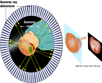 HowStuffWorks "How Nuclear Medicine Works"