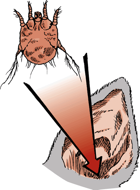 Mite Infestation (Mange, Acariasis, Scabies) of Cats: Skin ...