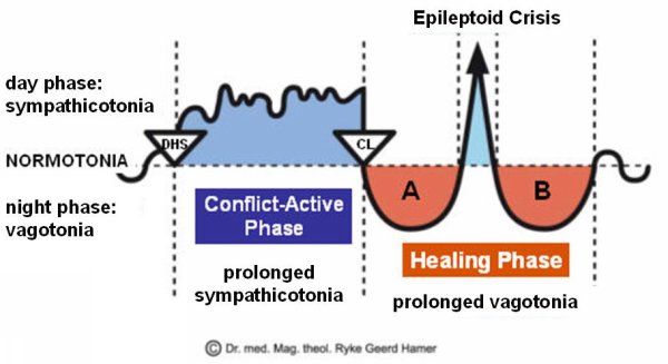 Infection" Theory