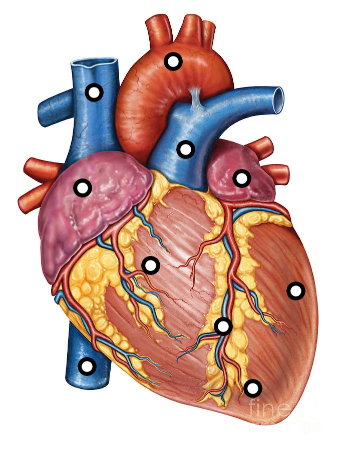 Mitral Regurgitation: is an abnormal reversal of blood fl ...