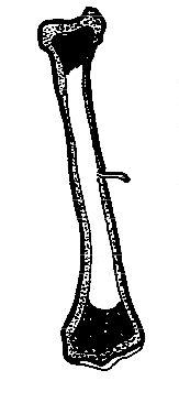Section_through_long_bone.JPG