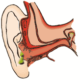 Swimmer's Ear