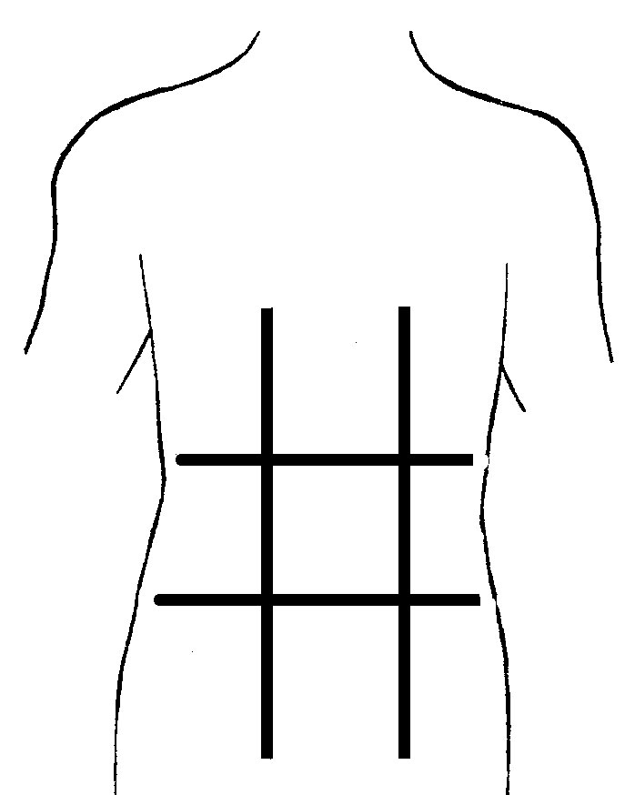 Heart Diagram Unlabeled