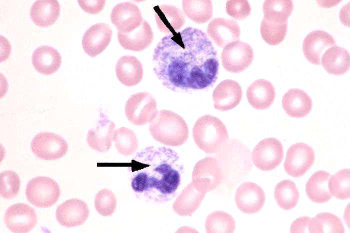 Neutrophil Image - ClipArt Best