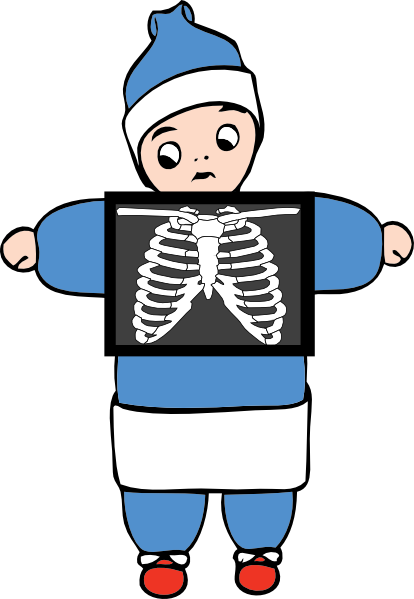 X-ray Clip Art - vector clip art online, royalty free ...
