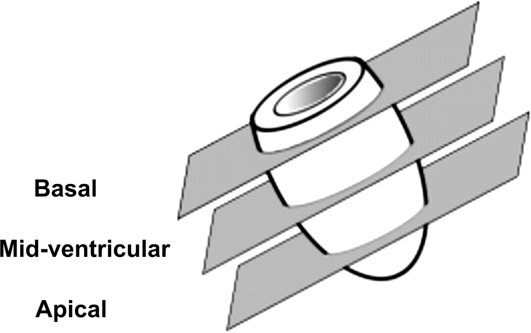 Measurement of myocardial mechanics in mice before and after ...