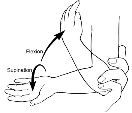 Nursemaid's Elbow? How About Ear-Piercing Scream-Inducing ...