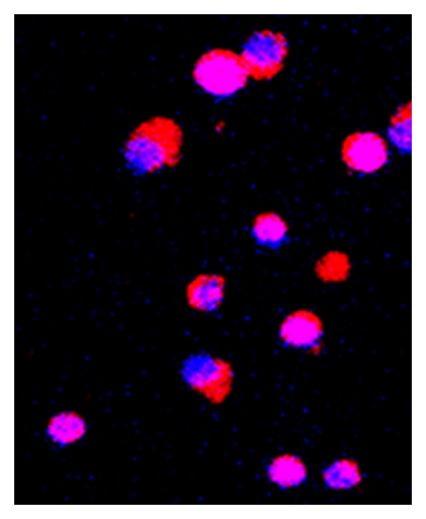 The 19 kDa Mycobacterium tuberculosis Lipoprotein (LpqH) Induces ...