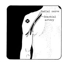 Pain Medication Injections at Home