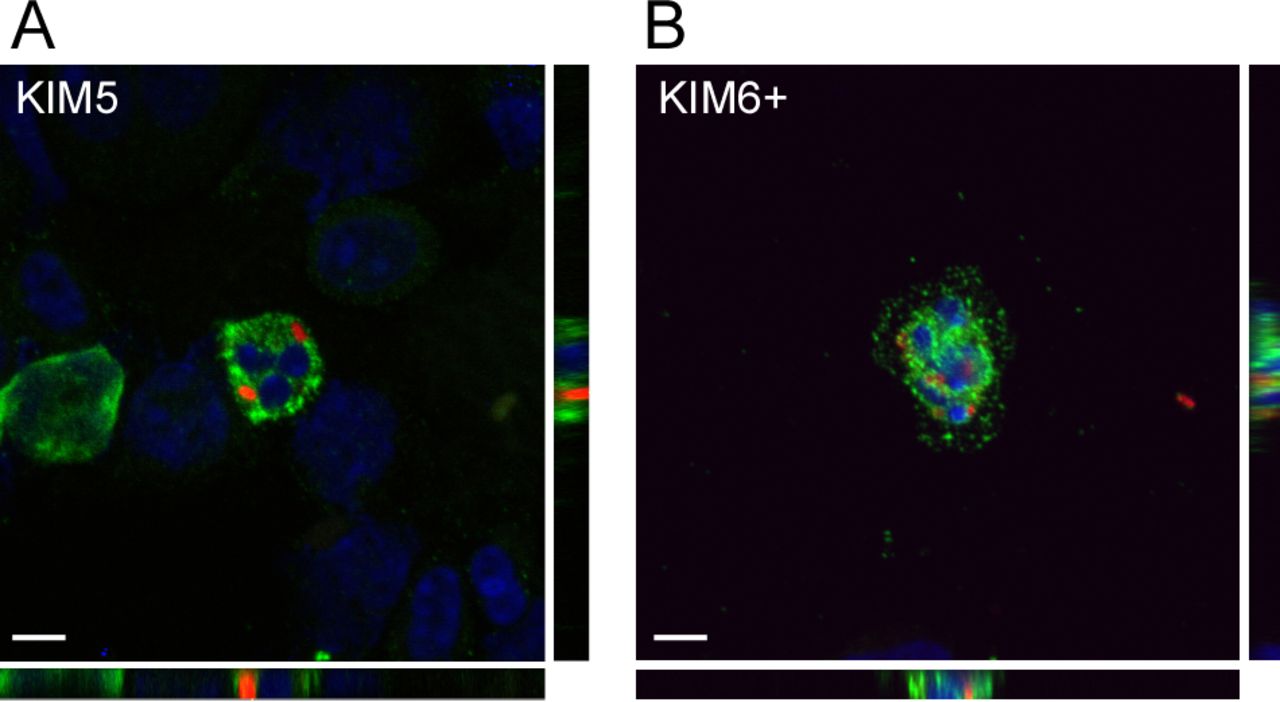 Yersinia pestis Subverts the Dermal Neutrophil Response in a Mouse ...