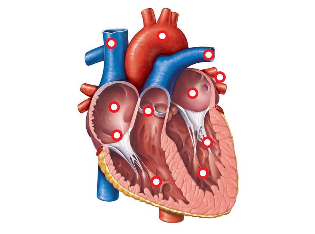 Superior vena cava- brings oxygen poor blood to the right ...