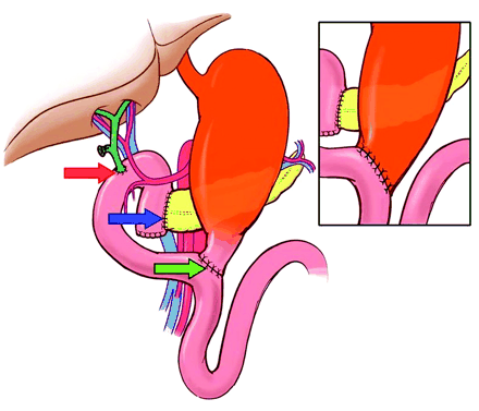 Doctors Gates: Diagrams for Surgical Procedures of Chronic ...