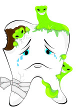 Tooth Decay Clipart