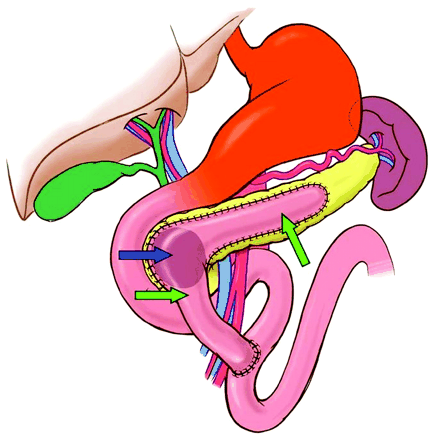Doctors Gates: Diagrams for Surgical Procedures of Chronic ...