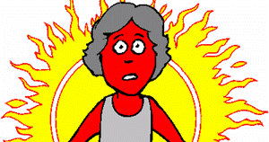Sunburn Clipart - Tumundografico