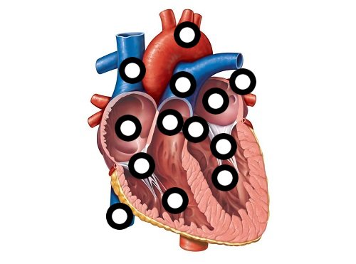 Aorta -Largest artery in body -Carries oxygen rich blood ...