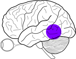 posterior-temporal-lobe-mass- ...