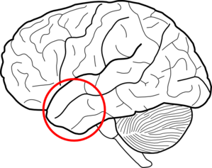 anterior-temporal-lobe-md.png