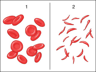 Structural Biochemistry/Hemoglobin - Wikibooks, open books for an ...