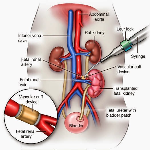 Birth of a New Earth: ABORTED BABIES HARVESTED TO GROW KIDNEY ...